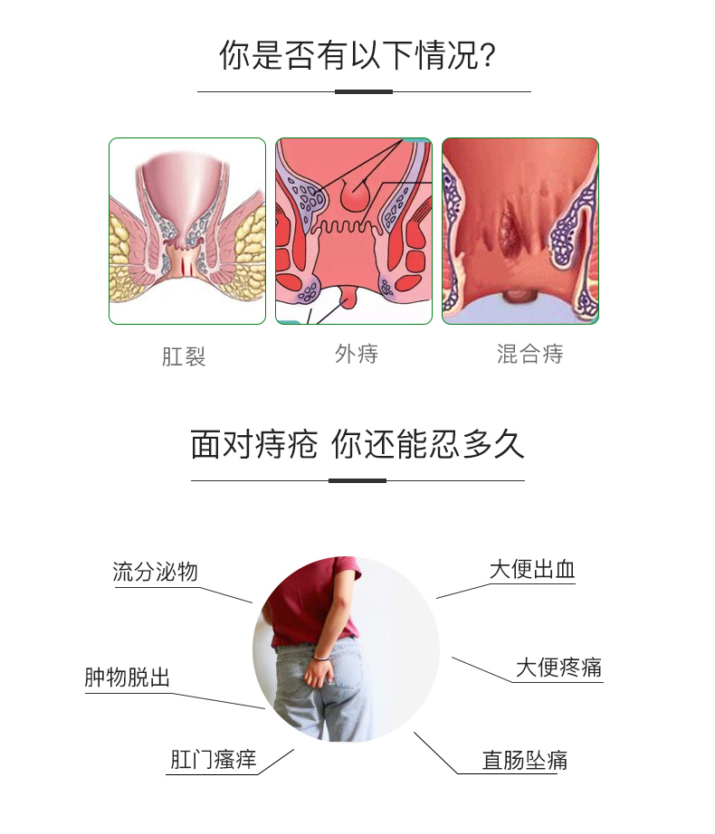 痔疮膏内痔外痔痔疮栓痔疮药oem加工贴牌