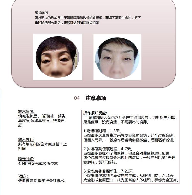 葡聚糖干细胞的工作原理葡聚糖干细胞的注意事项