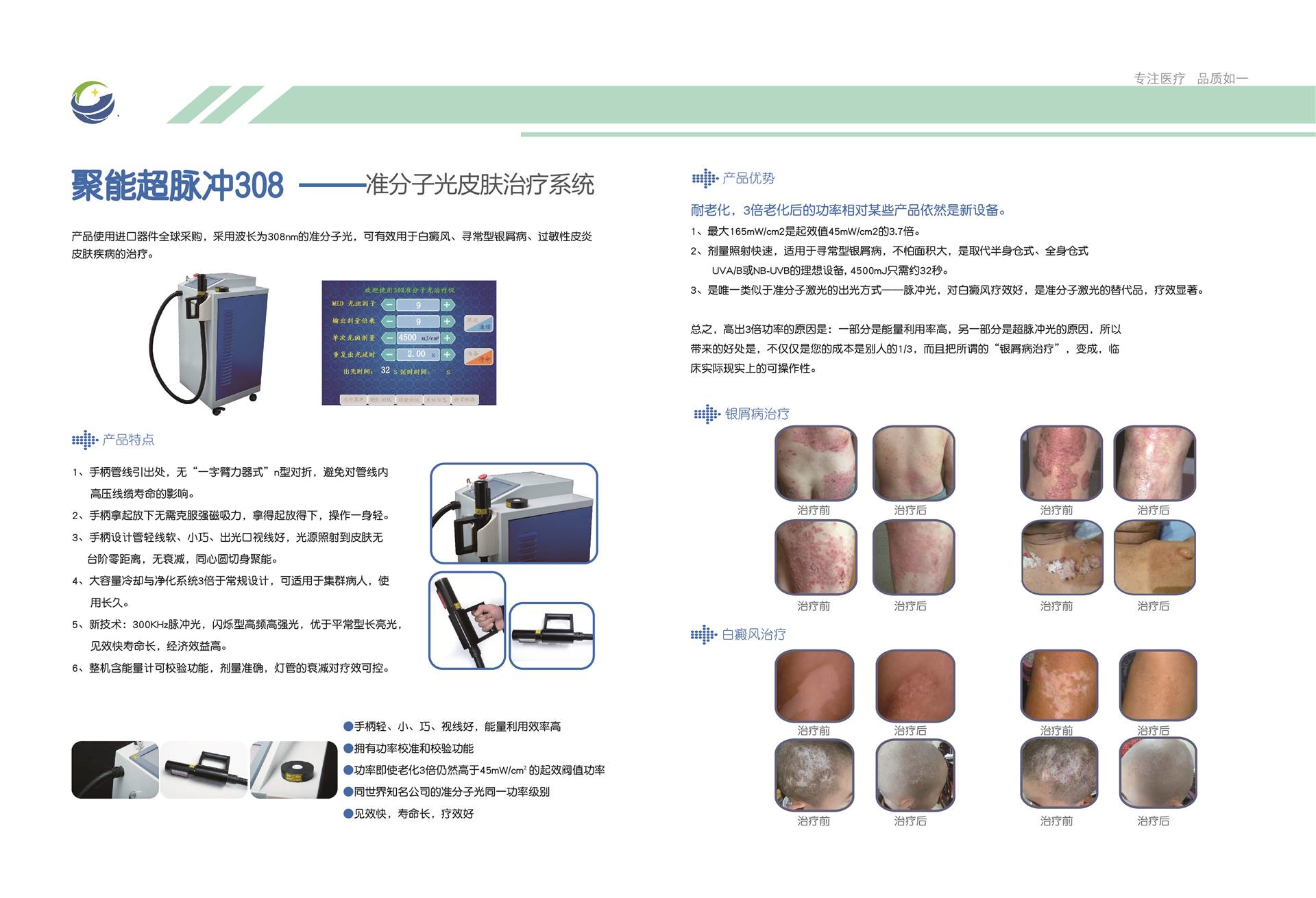 皮肤科银屑病治疗仪紫外线光疗仪