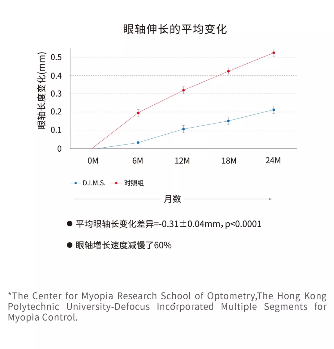 hoya豪雅镜片新乐学儿童多点近视离焦学生控制度数眼镜片定制