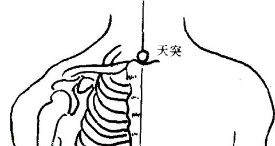 天突穴 所屬經絡 任脈 定位取穴 突穴在胸骨上窩正中.