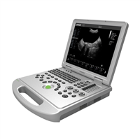笔记本式兽用彩超机,便携式兽用B超机,大为高清兽用B超机价格
