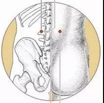前列腺增生针灸位置图图片