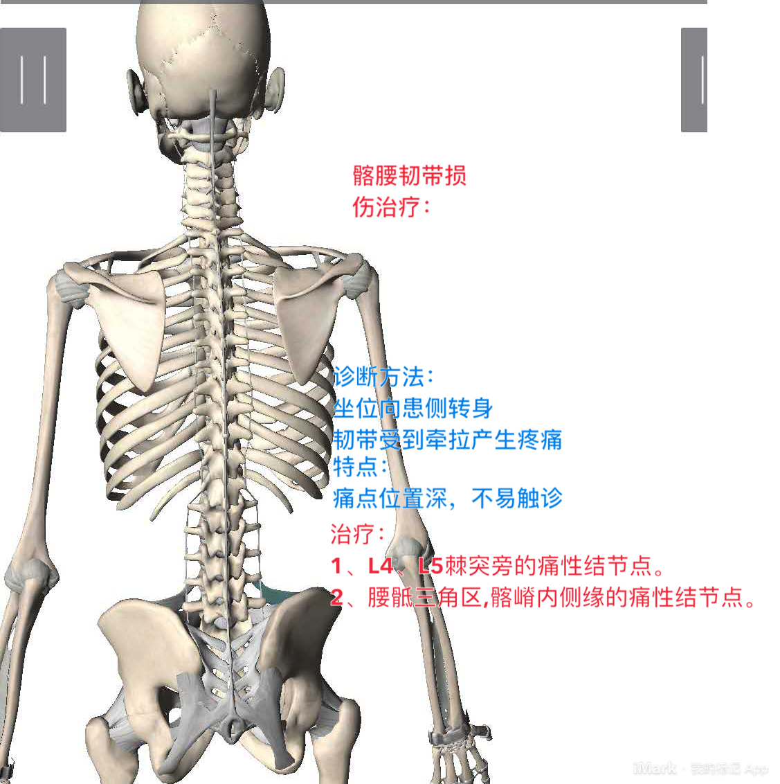 叶颖华肌筋膜疼痛对照讲解叶颖华