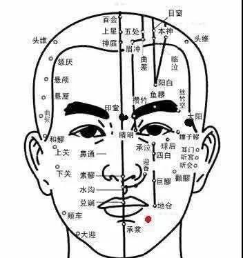中医针灸培训速成班面瘫十二针