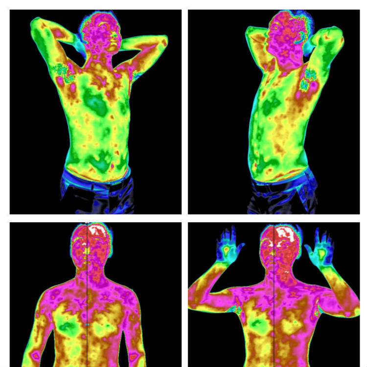 华夏红外热像仪医用红外线热成像检测仪中医治未病科检测设备