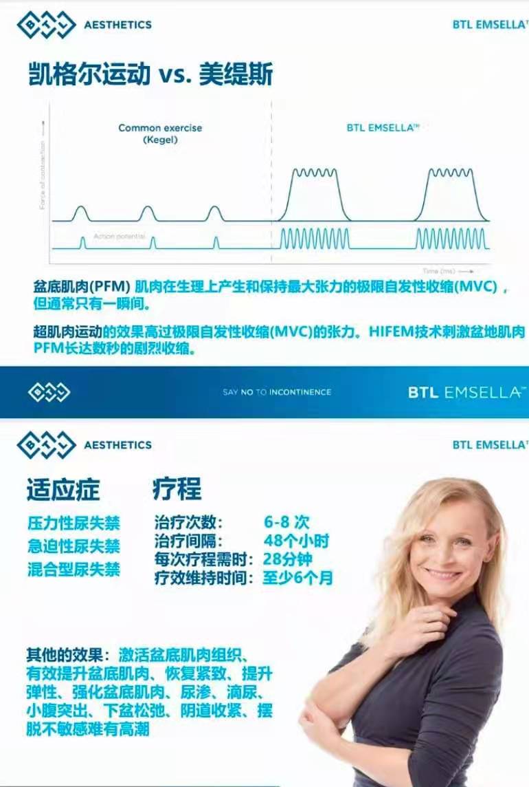 btl美缇斯幸福椅真的有效果吗工作原理是什么