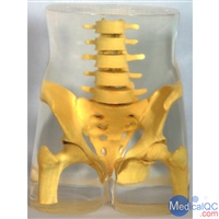 骨盘模体 RSDRS-113 脊椎体模 维保壹年 经济实用 新品上市 研发设备