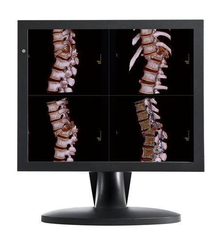 国产医用显示器巨鲨显示器巨烽奇菱chilin显示器魔言维修