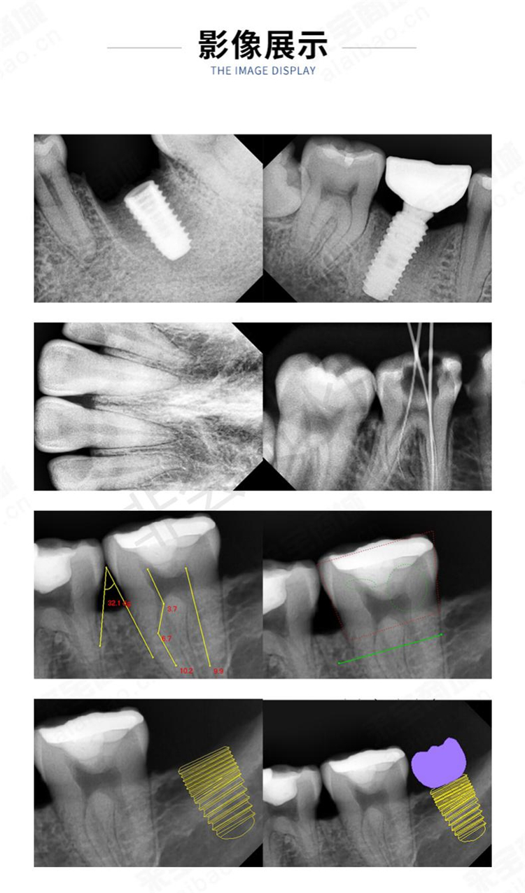 口腔x射线机便携式x光机迪美