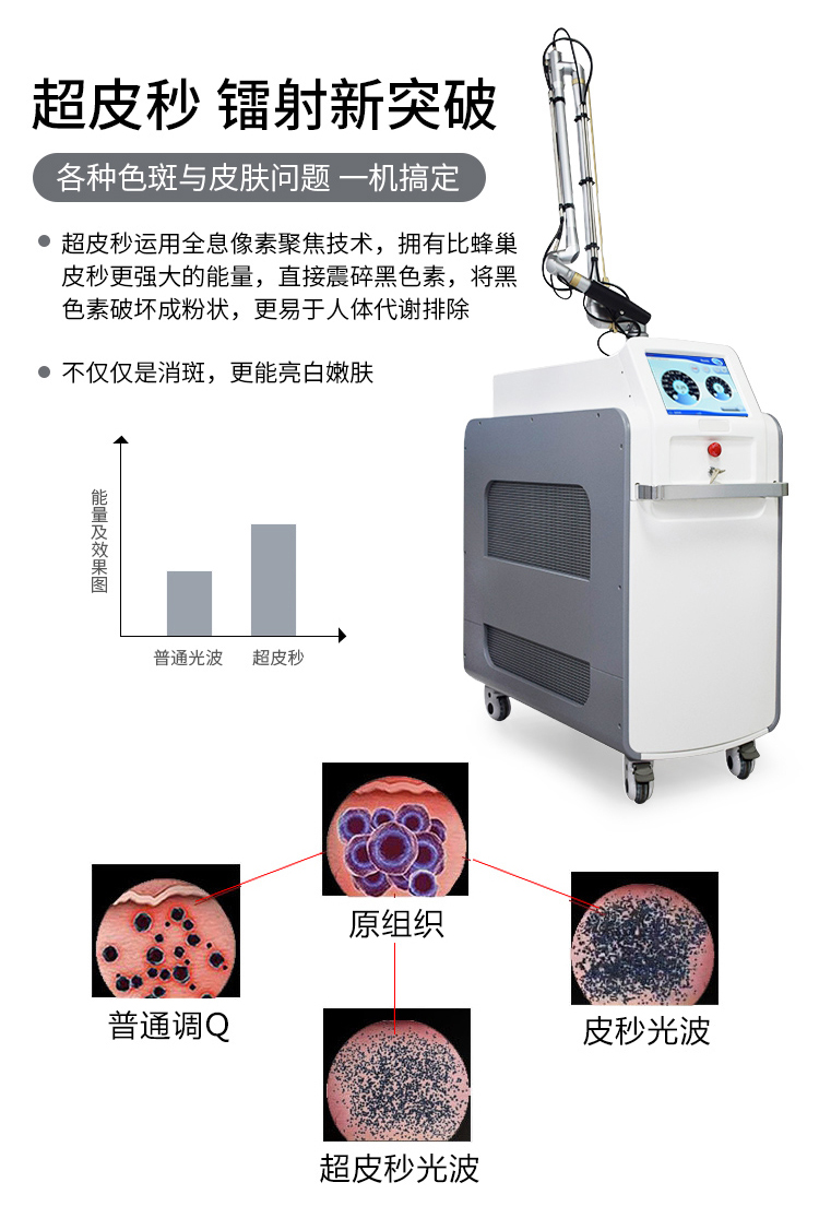 产品 皮秒是目前全世界较先进的激光祛斑仪器,它的激光发射速度非常