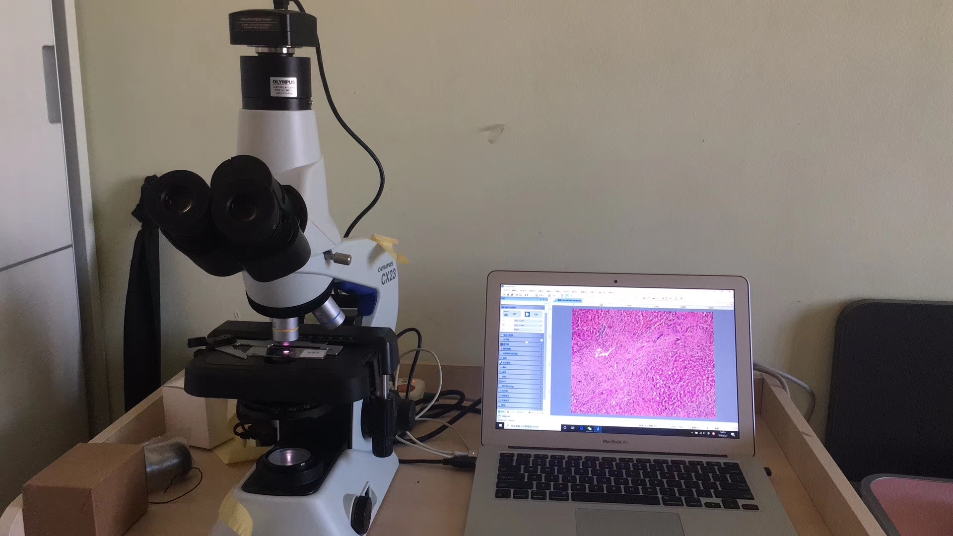 奧林巴斯生物顯微鏡cx23升級改造三目分光明確操作簡單成本低