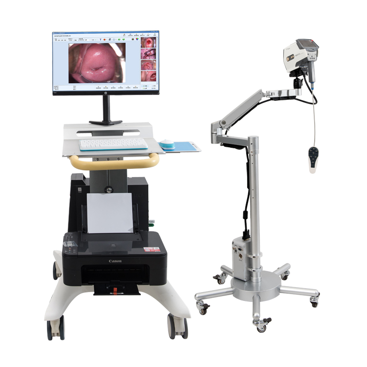 数码电子阴道镜ykd3001妇科检查阴道镜