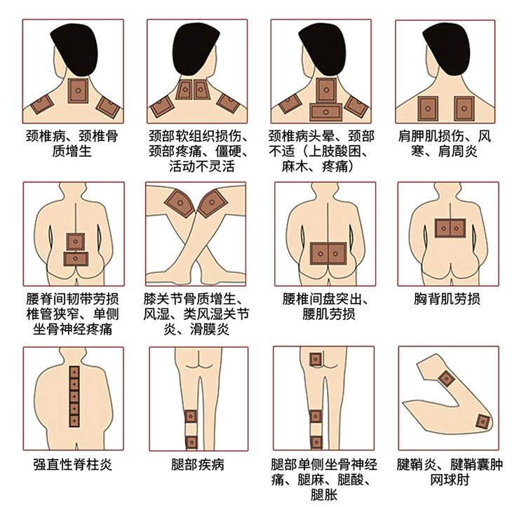 艾草贴的使用方法图解图片