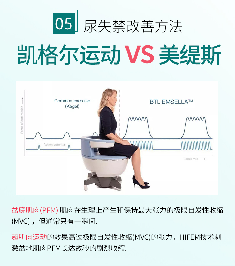 英国btl进口仪器美缇斯盆底肌修复仪