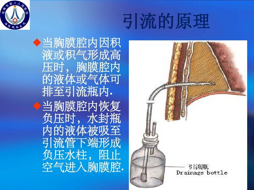 一次性使用胸腔引流装置