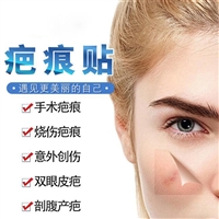 疤痕贴厂家 疤痕贴贴牌 疤痕贴代加工