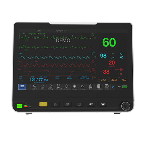 宠物监护设备 24小时宠物监护 宠物麻醉监护仪 宠物店监护仪厂家