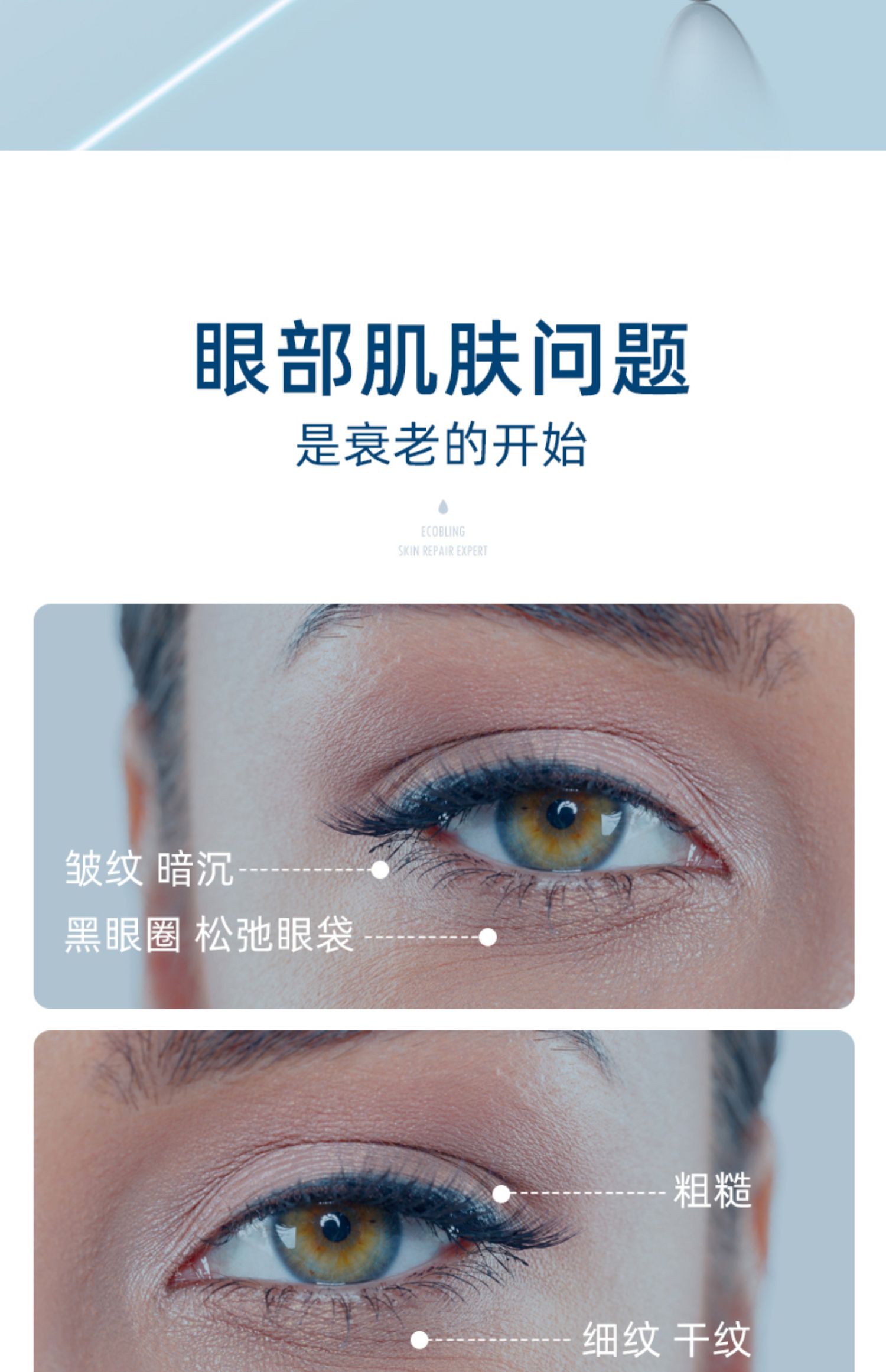 ecobling小尖刀提拉紧致淡化细纹眼袋家用电子美容仪器射频美眼仪