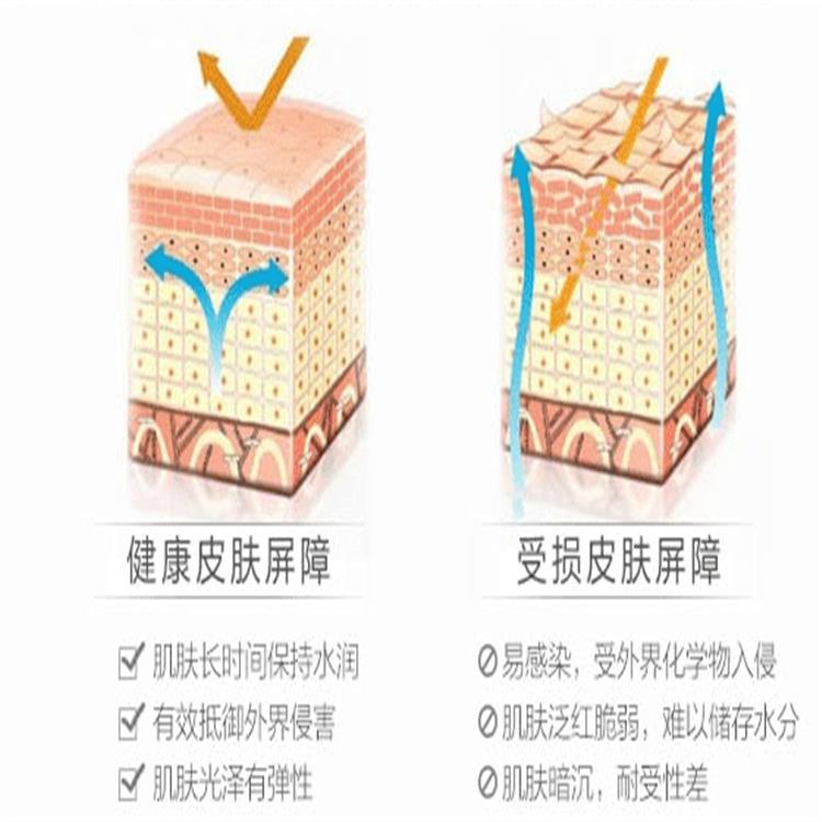 深圳祛斑中心_宋庙张中心祛斑皮掉图_祛斑中心