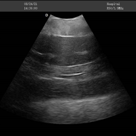 鲟鱼b超机 鱼类b超机 鲟鱼亲鱼B超性腺检查 鲟鱼做b超 