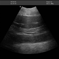 鲟鱼b超机 鱼类b超机 鲟鱼亲鱼B超性腺检查 鲟鱼做b超 
