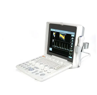 全数字超声诊断仪HY5590