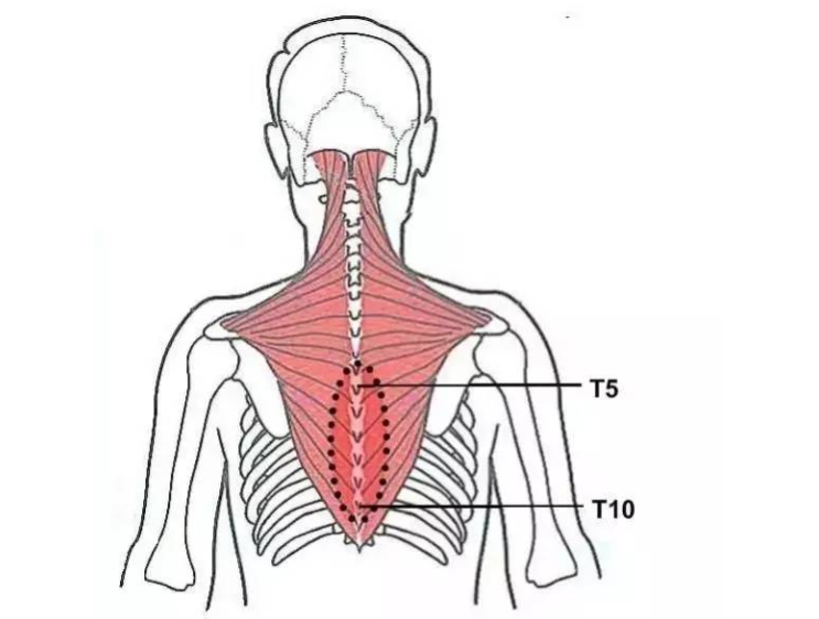 身体痛点位置图图片