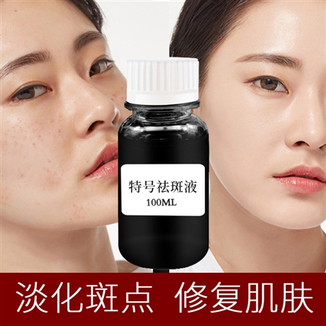 欧素研特号祛斑液章飞签吻芳颜同款美容院厂家