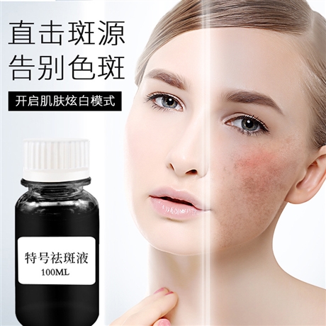 欧素研特号祛斑液章飞签吻芳颜同款美容院厂家