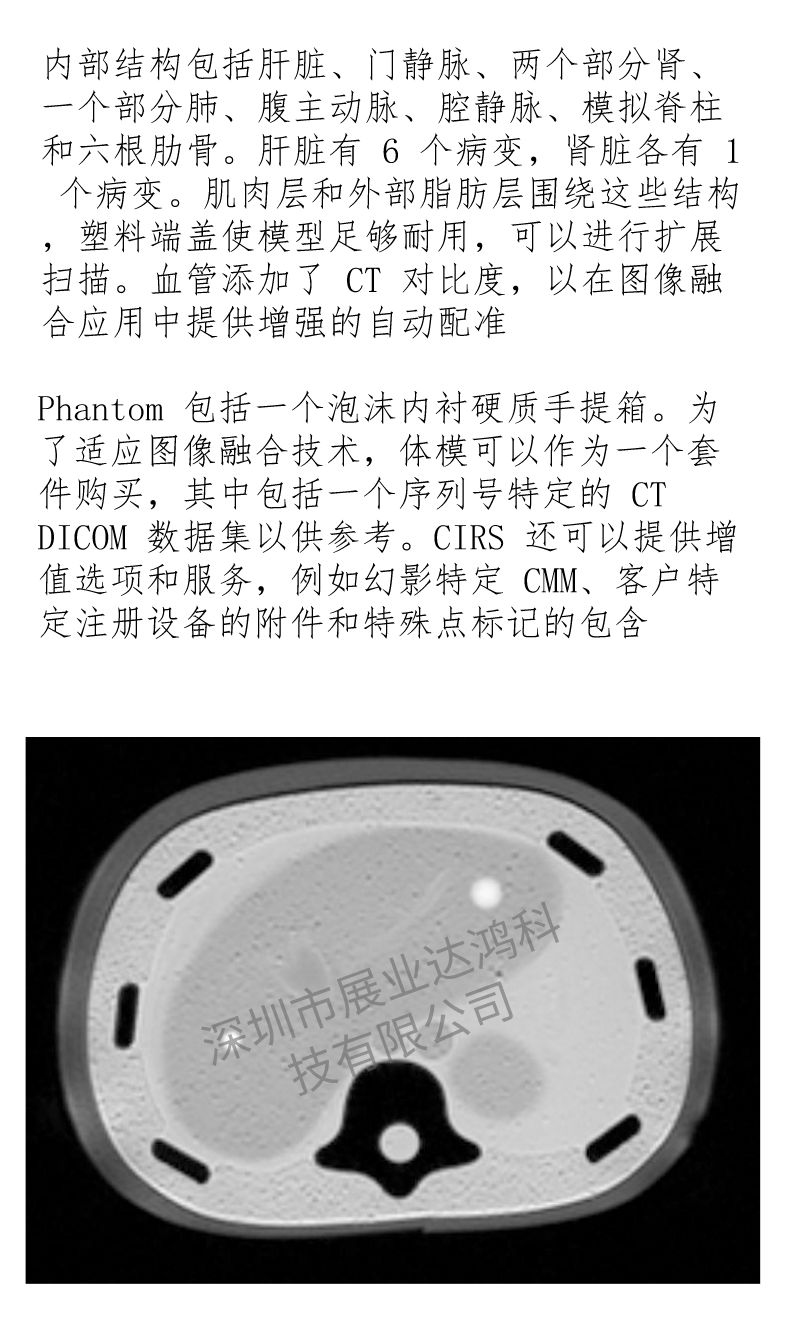 美国CIRS 057A腹部模体 超声模体 磁共振成像模体