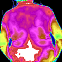 中医热CT 医用红外热像仪器  体检TMT红外热断层扫描仪