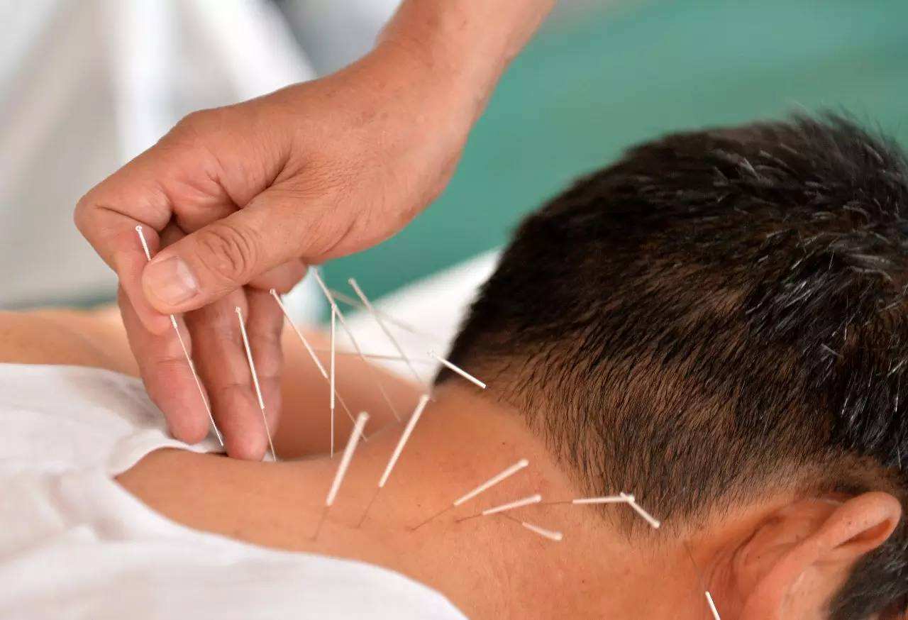 上岗必备的中医针灸师证书办理需要多少钱