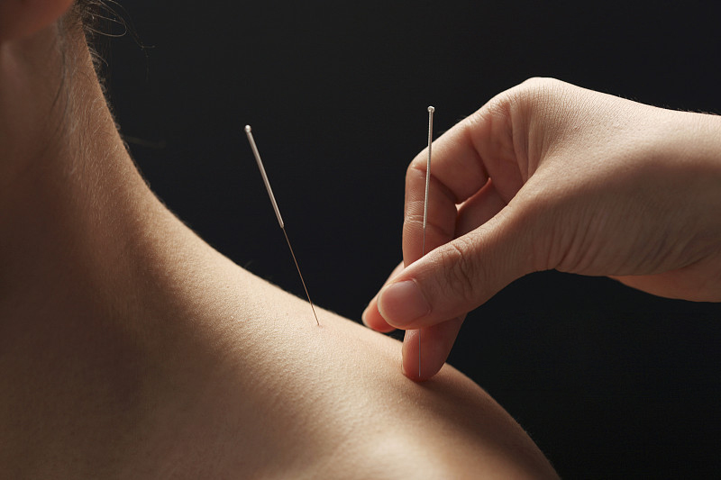 直接封神的证书-在哪代办;中级针灸师证书