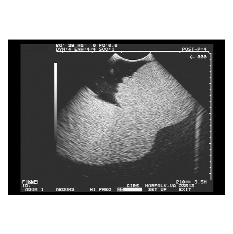 美国CIRS 065-20胎儿超声训练模体 高质量成像体模 产前超声检查模体