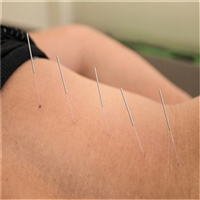 关于中医针灸师证报考条件-免费咨询