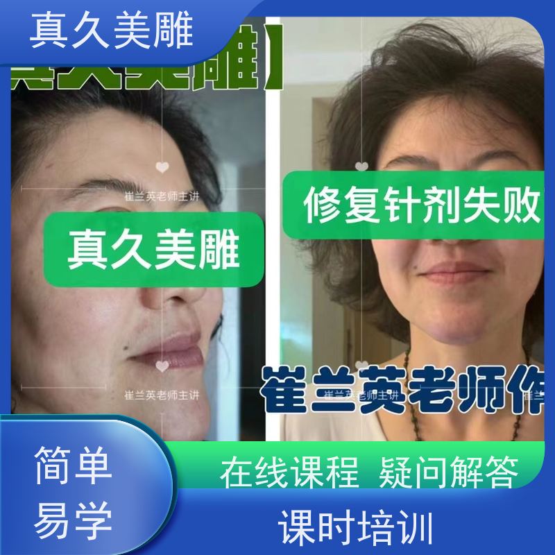 珍方健康管理 崔兰英针灸美雕减肥瘦身 鱼尾纹、法令纹、颈纹 欢迎来电咨询