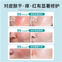 浙江械字号贴牌面膜贴牌加工暨大基因源头工厂