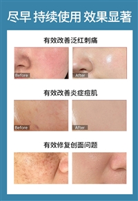 湖南医美医用美容院门店美白祛斑去痘面膜广州广东微肽生物OEMODM贴牌加工